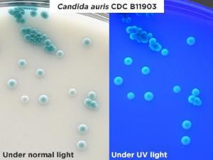 HardyChrom Candida + auris under normal and UV light