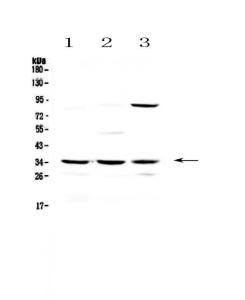 Anti-Alpha 1 Microglobulin Polyclonal Antibody