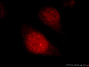Anti-SART1 Rabbit Polyclonal Antibody