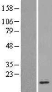 CDK2AP1 Overexpression lysate (adult normal) western blot NBL1-09037