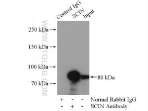 Anti-SCIN Rabbit Polyclonal Antibody