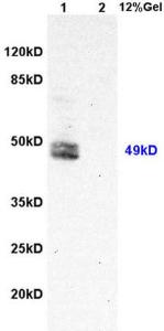 Anti-NS5A Rabbit Polyclonal Antibody