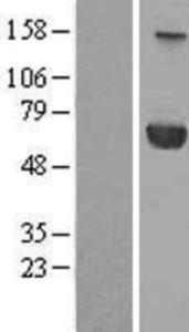 PPM1J Overexpression Lysate (Adult Normal), Novus Biologicals (NBL1-14664)