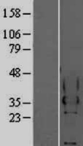 CEACAM4 Overexpression lysate (adult normal) western blot NBP2-04208