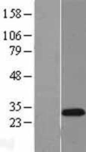 MASH1 Overexpression Lysate (Adult Normal), Novus Biologicals (NBL1-07759)