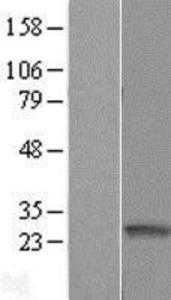 ARFRP1 Overexpression Lysate (Adult Normal), Novus Biologicals (NBL1-07661)
