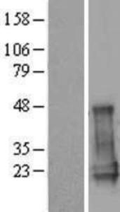 CGGBP1 Overexpression lysate (adult normal) western blot NBP2-09122