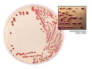 HardyCHROM Campy agar with Campylobacter jejuni