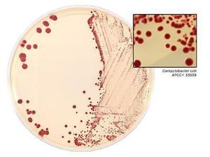 HardyCHROM Campy agar with Campylobacter coli