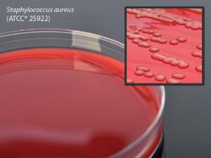 Blood Agar Plate, 5% Sheep Blood in Tryptic Soy Agar (TSA) Base, 15 × 100 mm plate, Hardy Diagnostics
