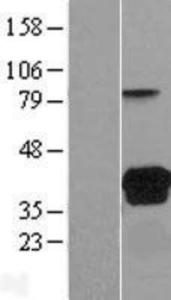 VSIG2 Overexpression Lysate (Adult Normal), Novus Biologicals (NBL1-17762)