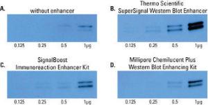 Pierce™ SuperSignal™ Western Blot Enhancer, Thermo Scientific