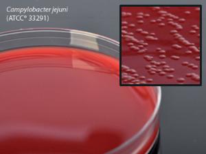 Campy CVA Agar with 5% Sheep Blood, Hardy Diagnostics