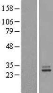 PRL Lysate (Adult Normal), Novus Biologicals (NBP2-10184)