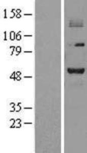 PRMT2 Overexpression Lysate (Adult Normal), Novus Biologicals (NBL1-14793)