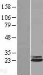 Apc10 Overexpression Lysate (Adult Normal), Novus Biologicals (NBL1-07512)