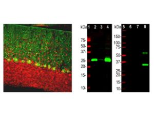 Left: Calbindin expression (green) in rat cerebellum by IHC. Red: rabbit anti-MeCP2 (R-1810-100). Right: WB analysis of rat cerebellum (2), pig hippocampus (3), cow cerebellum (4), parvalbumin (6), calretinin (7), His-tagged calbindin (8).