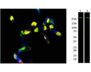 Left: SH-SY5Y cells stained for Nestin (green) and Vimentin (R-1699-100, red). Right: WB of nestin expression in rat C6 (Lane 1) and human SH-SY5Y (Lane 2) cell lysates. The antibody (1:1,000) detects one specific band running at ~260 kDa corresponding to full-length nestin protein.