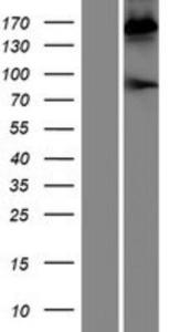 Pregnancy Zone Protein Lysate (Adult Normal), Novus Biologicals (NBP2-10853)