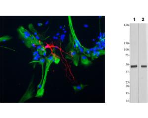 Left: Mixed neuron-glial cell cultures stained for CNP (red) and GFAP (green). Right: WB of rat brain tissue homogenates probed with anti-CNP antibody at 1:5,000 (Lane 1) and 1:20,000 (Lane 2).