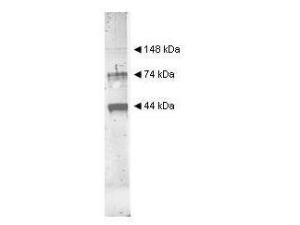Anti-ADH1 Rabbit Polyclonal Antibody