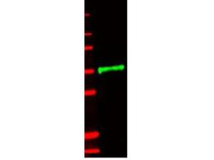 Anti-IL1R2 Rabbit Monoclonal Antibody [clone: 8G1]