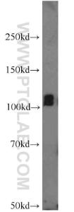 Anti-ITPKB Rabbit Polyclonal Antibody