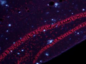 Combined Amylo-Glo labeling of amyloid plaques (blue) with ethidium bromide Nissl (cell body) counterstain (red) in the dentate gyrus region of the hippocampus of the AD/Tg mouse. UV light excitation.