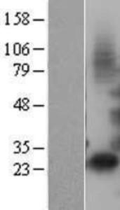 ATP6V1E2 Overexpression Lysate (Adult Normal), Novus Biologicals (NBL1-07844)