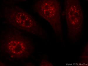 Anti-C14ORF166 Rabbit Polyclonal Antibody