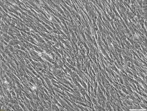 CELLvo™ human mesenchymal stem cells- Wharton's jelly (hMSC-WJ)