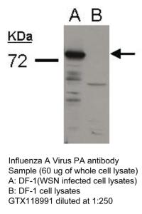 Anti-Influenza A PA Rabbit Polyclonal Antibody