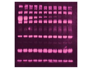 SYPRO® Ruby protein blot Stain
