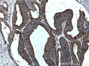 Anti-COSMC Rabbit Polyclonal Antibody