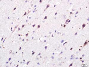 Formalin-fixed and paraffin embedded Rat Brain tissue labeled with Giantin/GOLGB1 Polyclonal Antibody (bs-13356R) at 1:200, followed by conjugation to the seconary antibody and DAB staining