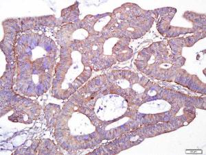 Formalin-fixed and paraffin embedded Human Cervix tissue labeled with Giantin/GOLGB1 Polyclonal Antibody (bs-13356R) at 1:200, followed by conjugation to the seconary antibody and DAB staining