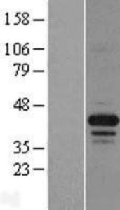 FAM131C Lysate (Adult Normal), Novus Biologicals (NBP2-04839)