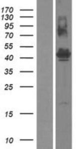 FAM187B Lysate (Adult Normal), Novus Biologicals (NBP2-05353)