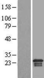 ARMER Overexpression Lysate (Adult Normal), Novus Biologicals (NBL1-07700)