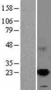 ARMET overexpression lysate (adult normal)-western blot-NBL1-07719