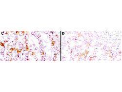 Anti-MSLN Mouse Monoclonal Antibody [clone: MB-G10]