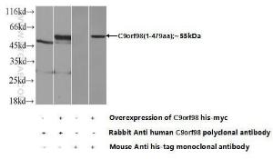 Anti-C9orf98 Rabbit Polyclonal Antibody