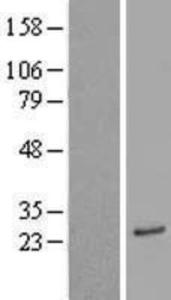 ASAH3 Overexpression Lysate (Adult Normal), Novus Biologicals (NBL1-07748)