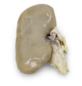 Preserved Pig Kidney with Polycystic Kidney Disease