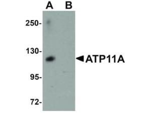 Anti-ATP11A Rabbit polyclonal antibody