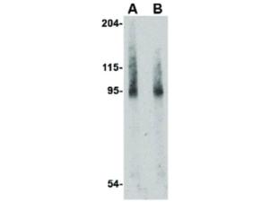 Anti-BICD2 Rabbit polyclonal antibody