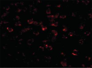 Anti-BCL2L11 Mouse monoclonal antibody [clone: 1C2C8]
