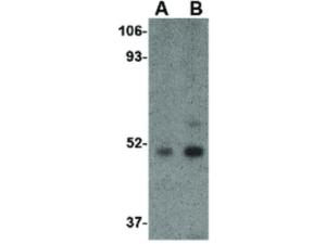 Anti-TBC1D10C Rabbit polyclonal antibody