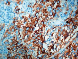 Anti-Melanoma Mouse Monoclonal Antibody [clone: HMB45]