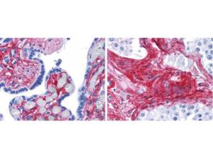 Anti-COL6A1 Rabbit polyclonal antibody